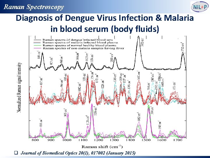 Raman Spectroscopy Diagnosis of Dengue Virus Infection & Malaria in blood serum (body fluids)