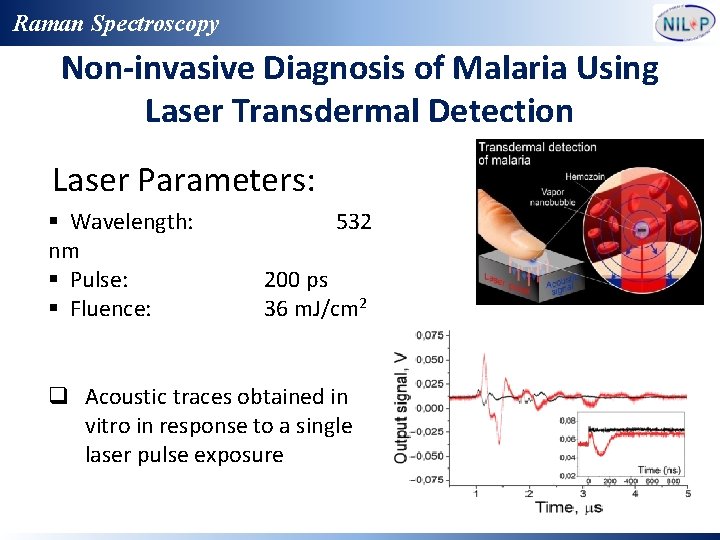 Raman Spectroscopy Non-invasive Diagnosis of Malaria Using Laser Transdermal Detection Laser Parameters: § Wavelength: