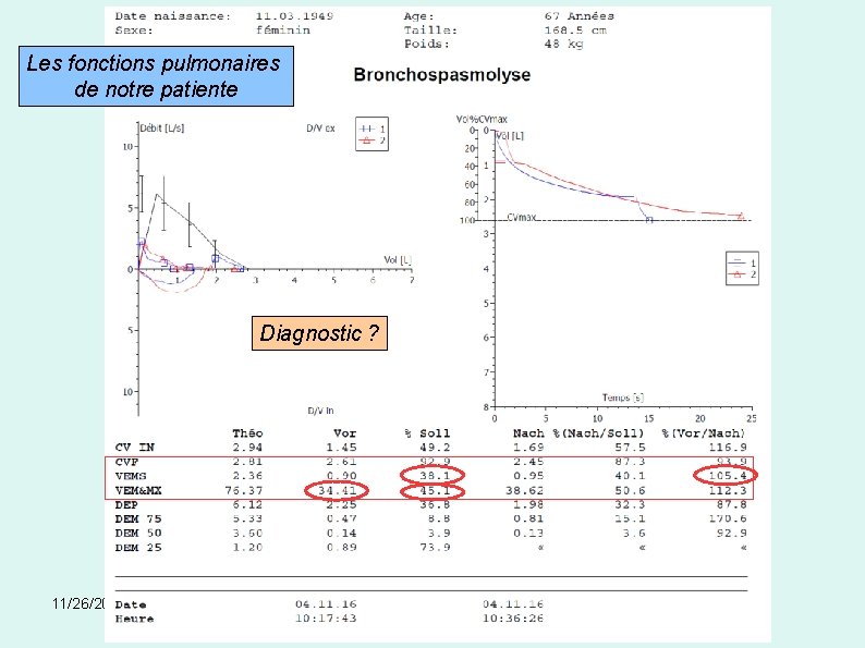 Les fonctions pulmonaires de notre patiente Diagnostic ? 11/26/2020 