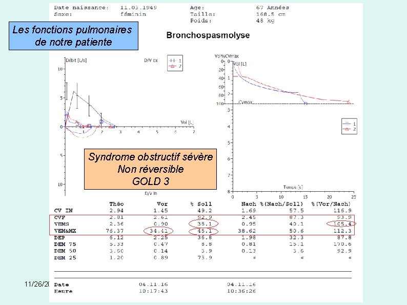 Les fonctions pulmonaires de notre patiente Syndrome obstructif sévère Non réversible GOLD 3 11/26/2020