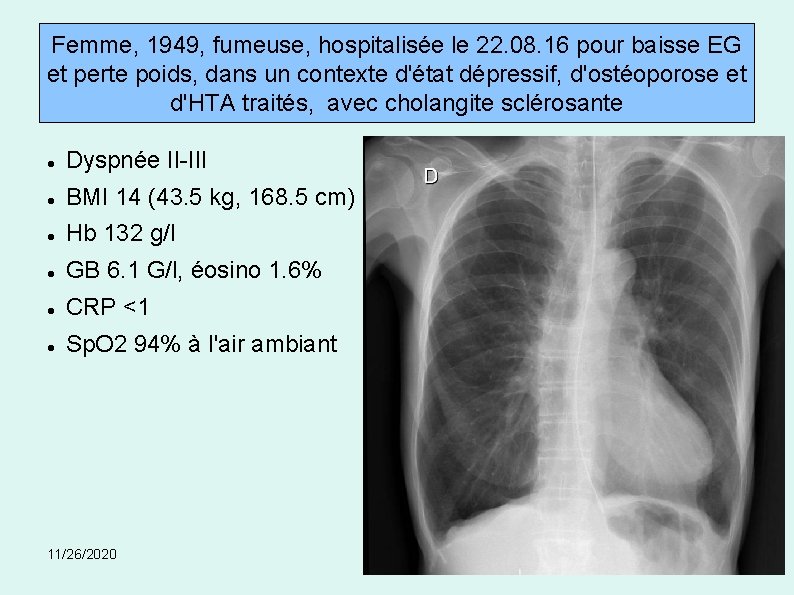 Femme, 1949, fumeuse, hospitalisée le 22. 08. 16 pour baisse EG et perte poids,