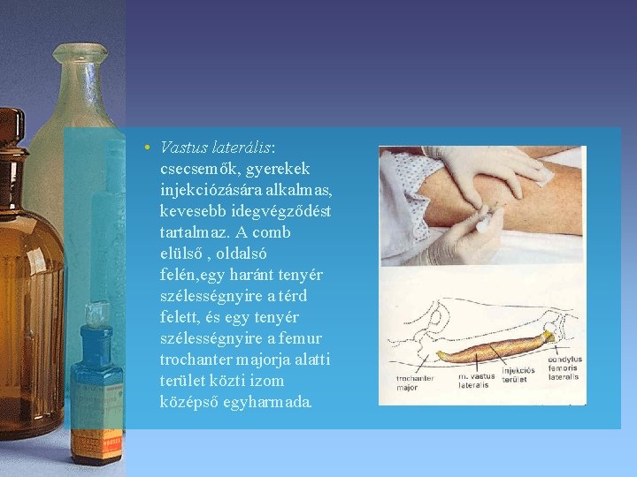 • Vastus laterális: csecsemők, gyerekek injekciózására alkalmas, kevesebb idegvégződést tartalmaz. A comb elülső • Vastus laterális: csecsemők, gyerekek injekciózására alkalmas, kevesebb idegvégződést tartalmaz. A comb elülső