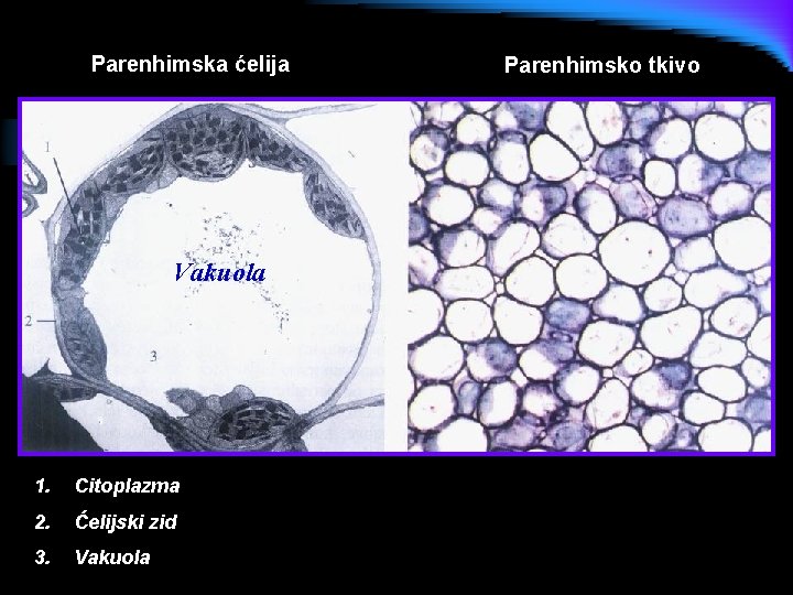 Parenhimska ćelija Vakuola 1. Citoplazma 2. Ćelijski zid 3. Vakuola Parenhimsko tkivo 