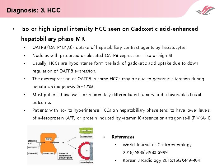 Diagnosis: 3. HCC • Iso or high signal intensity HCC seen on Gadoxetic acid-enhanced