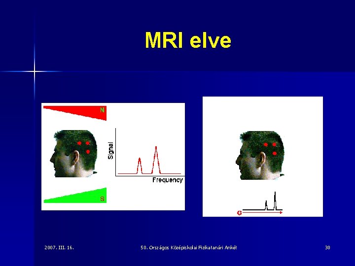 MRI elve 2007. III. 16. 50. Országos Középiskolai Fizikatanári Ankét 30 