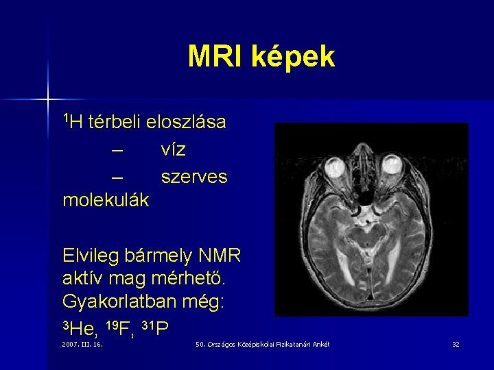 MRI képek 1 H térbeli eloszlása – víz – szerves molekulák Elvileg bármely NMR