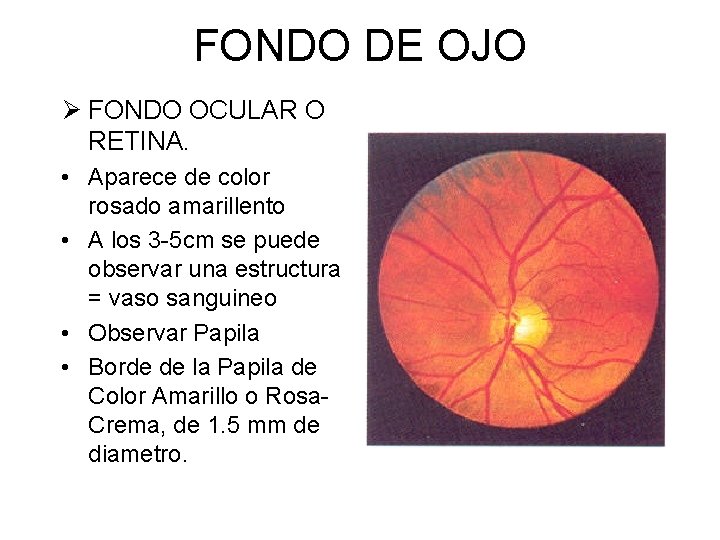 FONDO DE OJO Ø FONDO OCULAR O RETINA. • Aparece de color rosado amarillento