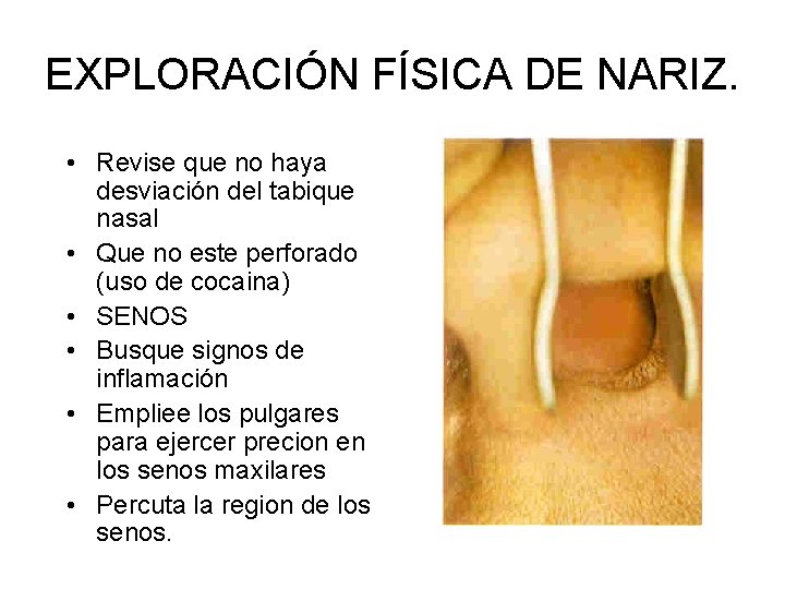 EXPLORACIÓN FÍSICA DE NARIZ. • Revise que no haya desviación del tabique nasal •