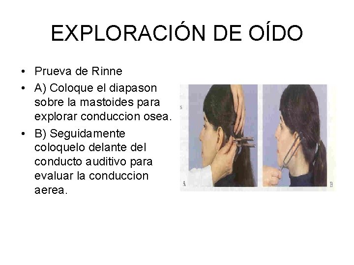 EXPLORACIÓN DE OÍDO • Prueva de Rinne • A) Coloque el diapason sobre la