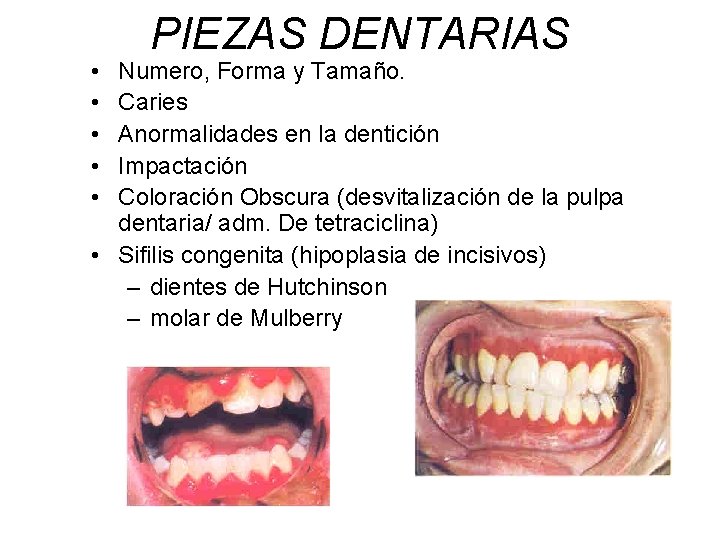  • • • PIEZAS DENTARIAS Numero, Forma y Tamaño. Caries Anormalidades en la