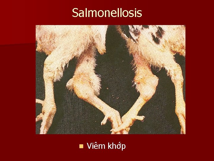 Salmonellosis n Viêm khớp 