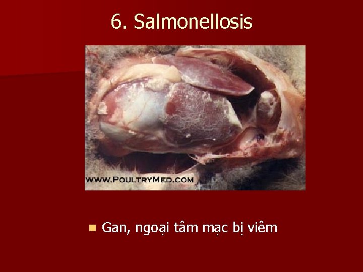 6. Salmonellosis n Gan, ngoại tâm mạc bị viêm 