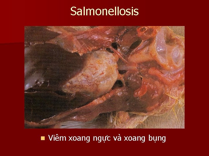 Salmonellosis n Viêm xoang ngực và xoang bụng 