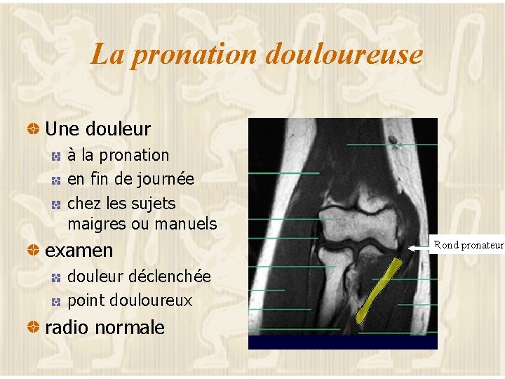 La pronation douloureuse Une douleur à la pronation en fin de journée chez les