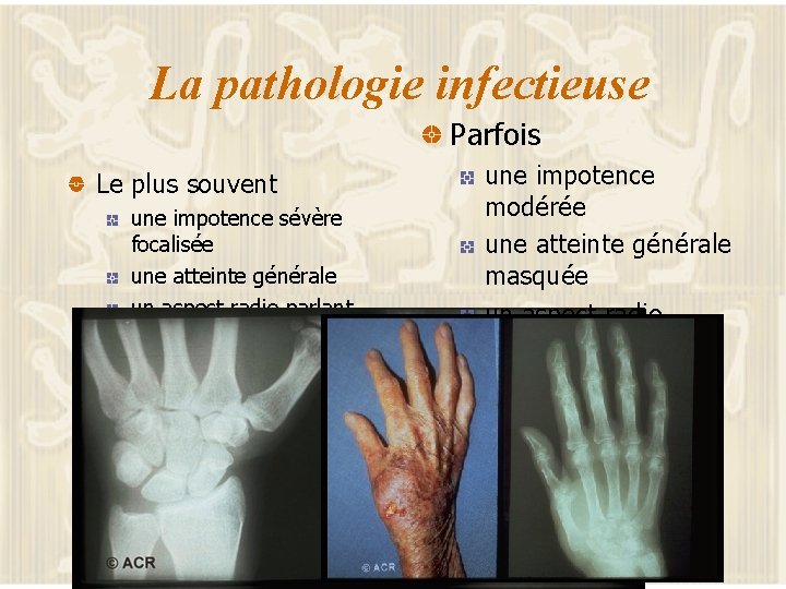 La pathologie infectieuse Parfois Le plus souvent une impotence sévère focalisée une atteinte générale