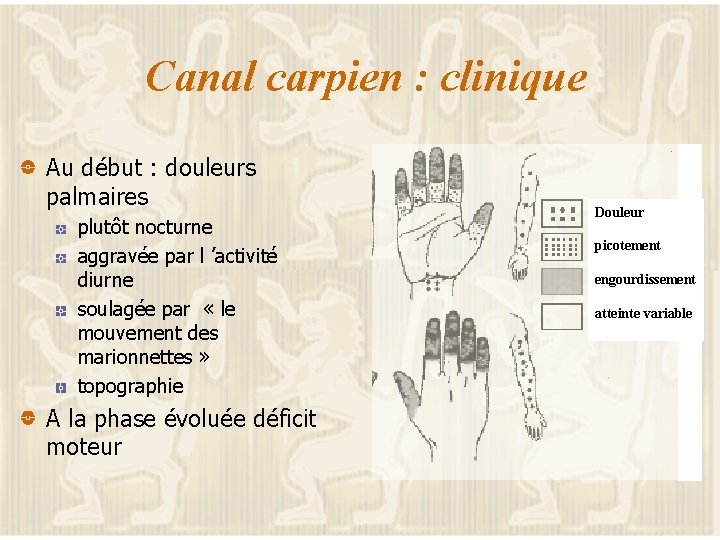 Canal carpien : clinique Au début : douleurs palmaires plutôt nocturne aggravée par l