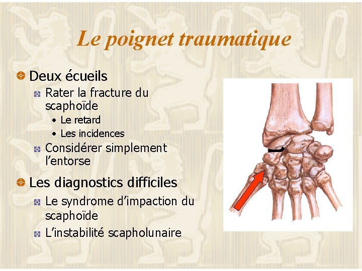 Le poignet traumatique Deux écueils Rater la fracture du scaphoïde • Le retard •