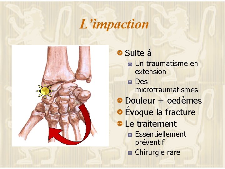 L’impaction Suite à Un traumatisme en extension Des microtraumatismes Douleur + oedèmes Évoque la