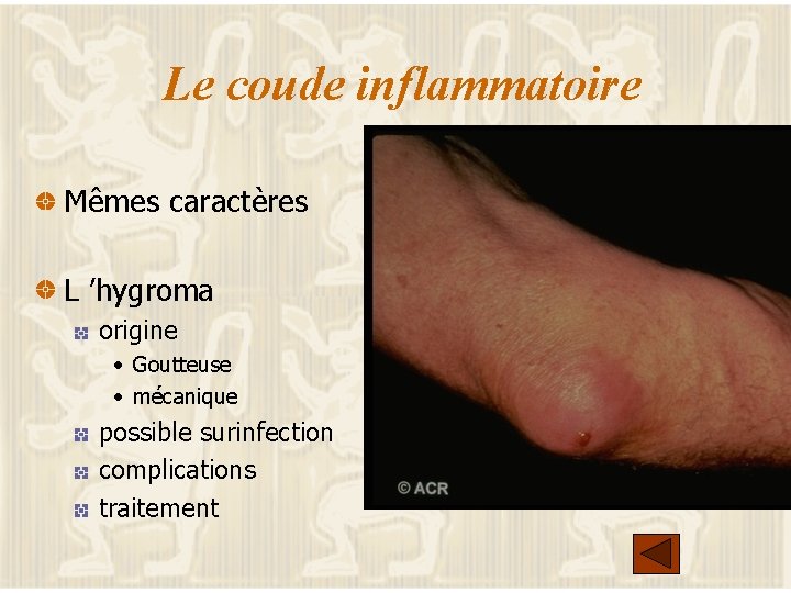 ALGORYHTME DIAGNOSTIC DUNE DOULEUR DU MEMBRE SUPERIEUR GENERALITES — free download
