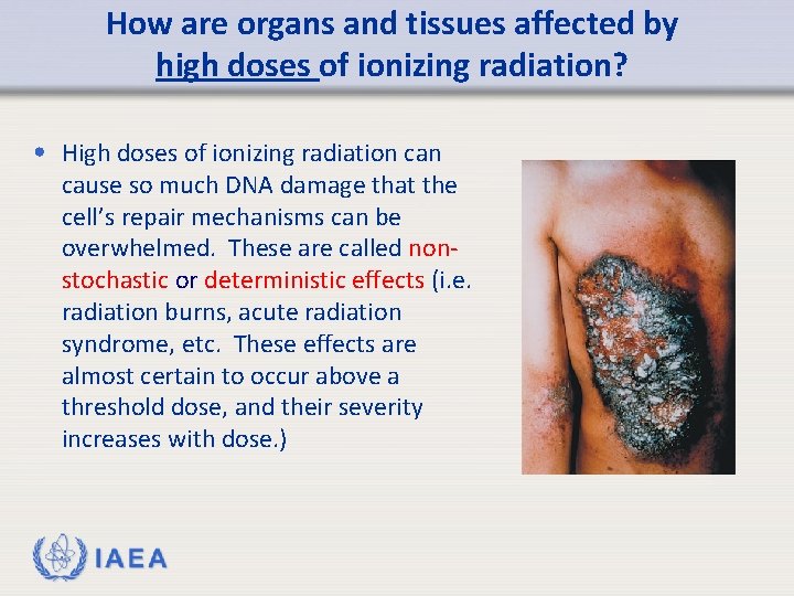 How are organs and tissues affected by high doses of ionizing radiation? • High