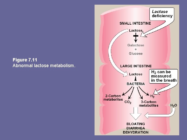 Figure 7. 11 Abnormal lactose metabolism. 