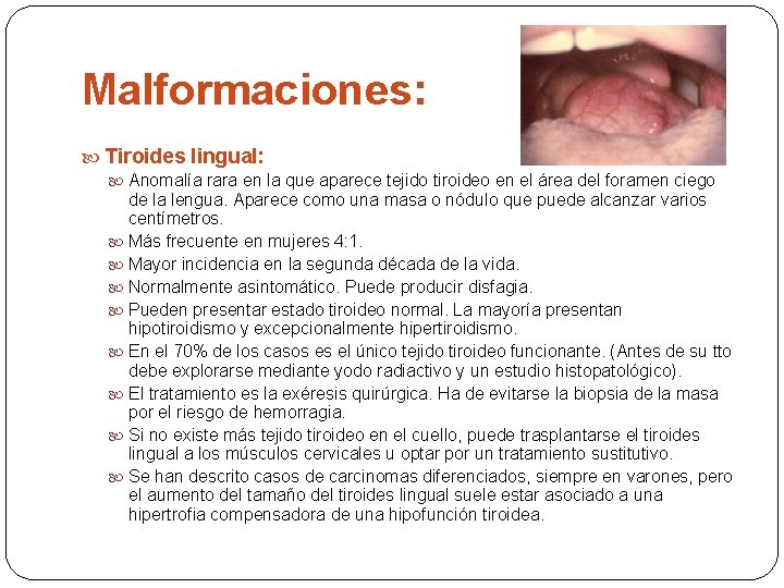 Malformaciones: Tiroides lingual: Anomalía rara en la que aparece tejido tiroideo en el área