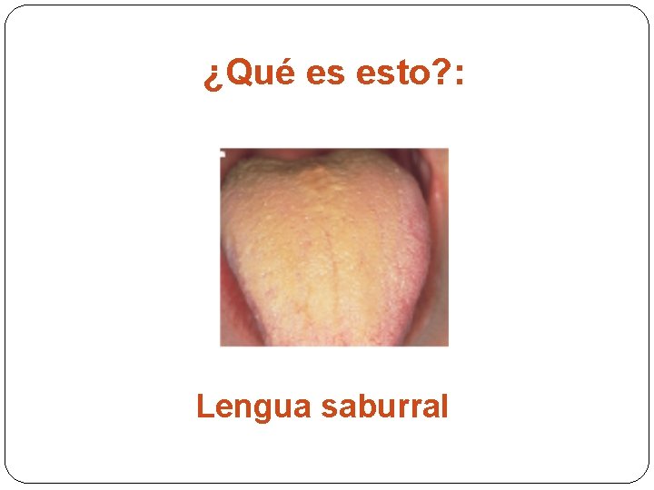 ¿Qué es esto? : Lengua saburral 