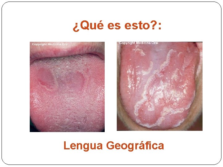 ¿Qué es esto? : Lengua Geográfica 