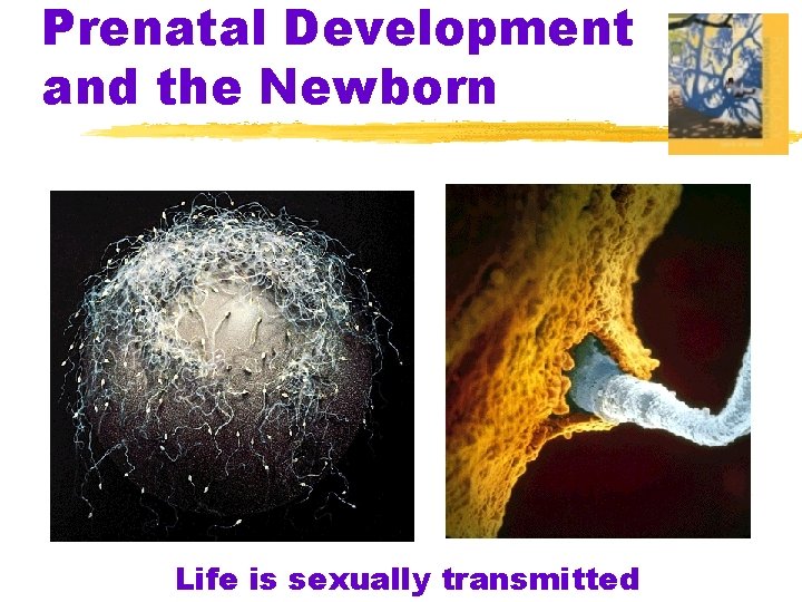 Prenatal Development and the Newborn Life is sexually transmitted 