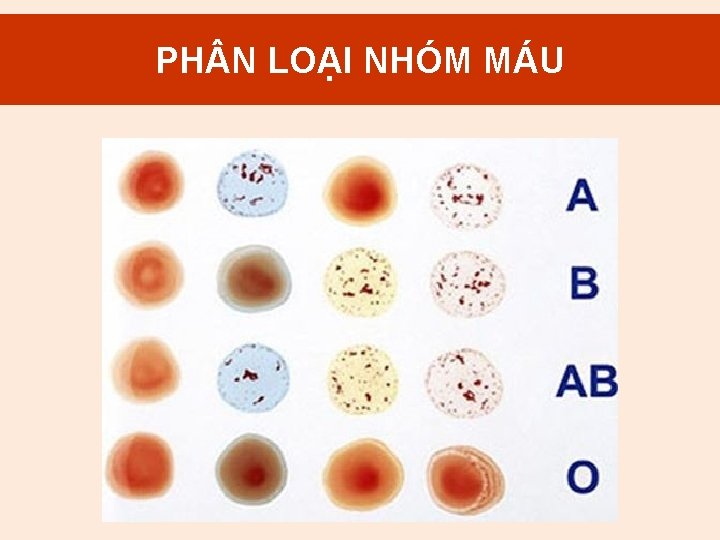 2. PH N Mục LOẠI đích NHÓM truyền. MÁU máu 