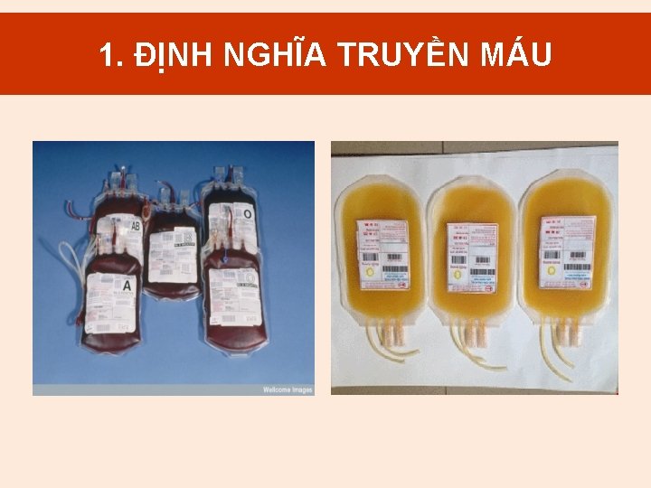 1. MÁU 1. ĐỊNH Định. NGHĨA nghĩa. TRUYỀN truyền máu 