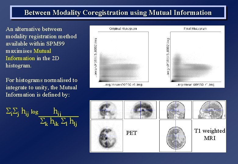 Between Modality Coregistration using Mutual Information An alternative between modality registration method available within