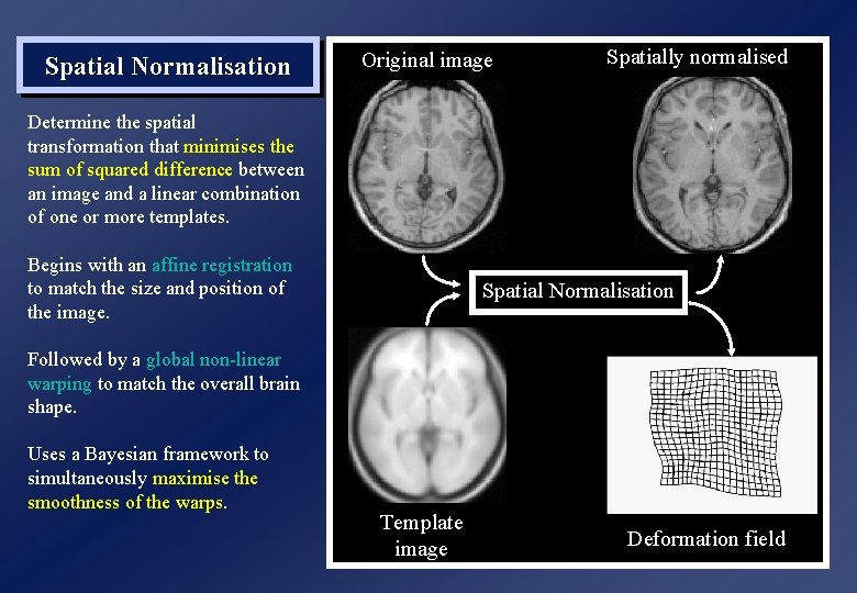 Spatial Normalisation Original image Spatially normalised Determine the spatial transformation that minimises the sum