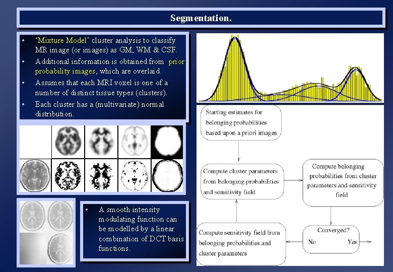 Segmentation. • • ‘Mixture Model’ cluster analysis to classify MR image (or images) as