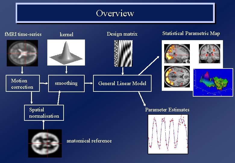 Overview Statistical Parametric Map f. MRI time-series kernel Design matrix Motion correction smoothing General