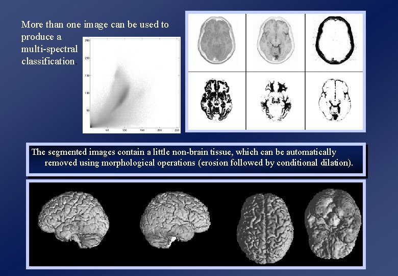 More than one image can be used to produce a multi-spectral classification. The segmented