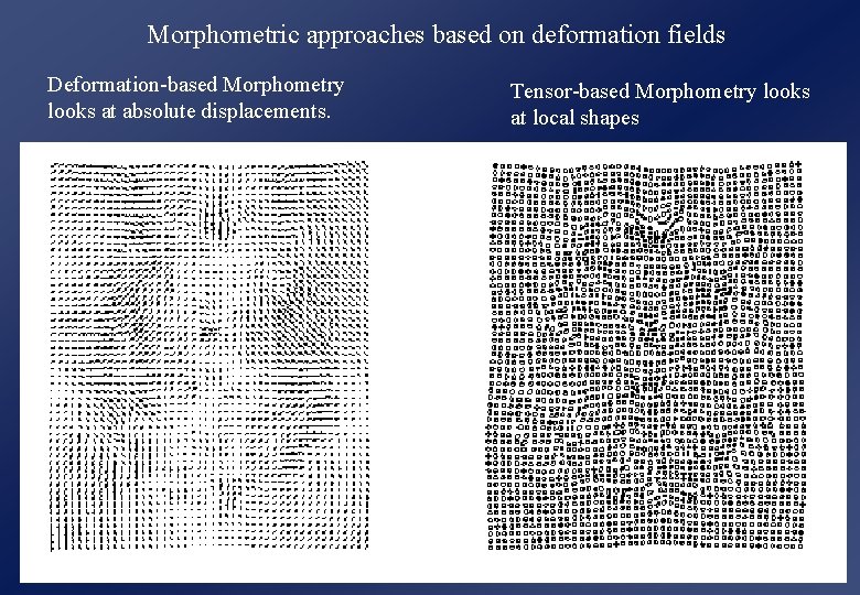 Morphometric approaches based on deformation fields Deformation-based Morphometry looks at absolute displacements. Tensor-based Morphometry