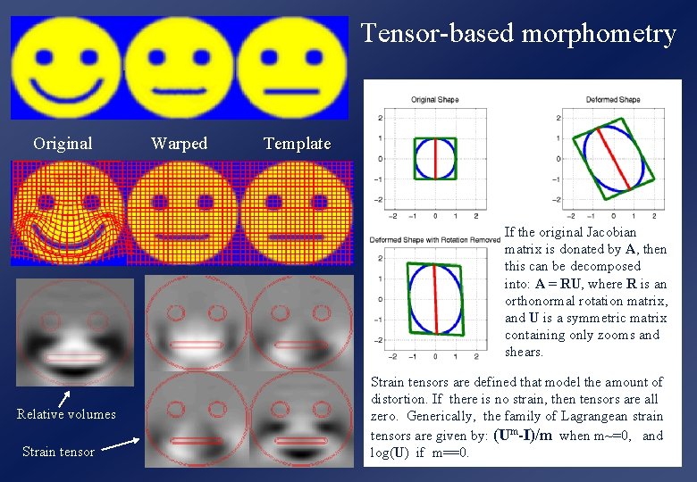 Tensor-based morphometry Original Warped Template If the original Jacobian matrix is donated by A,