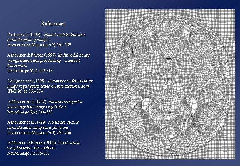 References Friston et al (1995): Spatial registration and normalisation of images. Human Brain Mapping