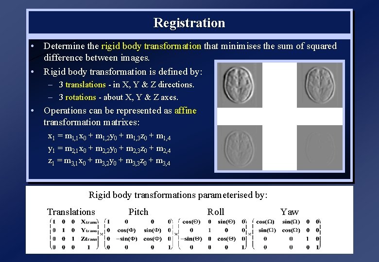 Registration • Determine the rigid body transformation that minimises the sum of squared difference