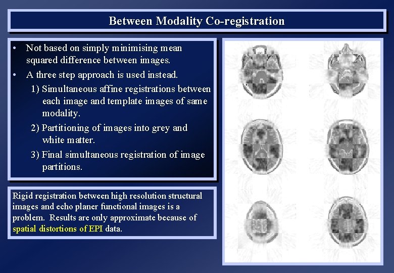 Between Modality Co-registration • Not based on simply minimising mean squared difference between images.