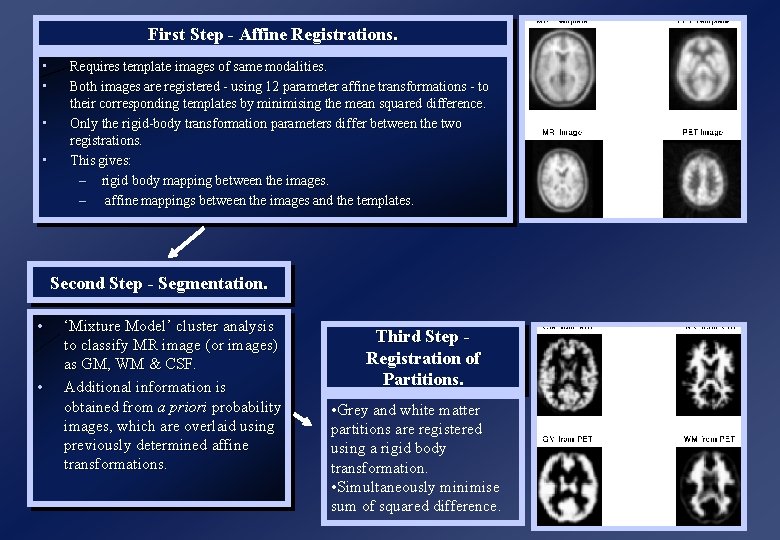 First Step - Affine Registrations. • • Requires template images of same modalities. Both