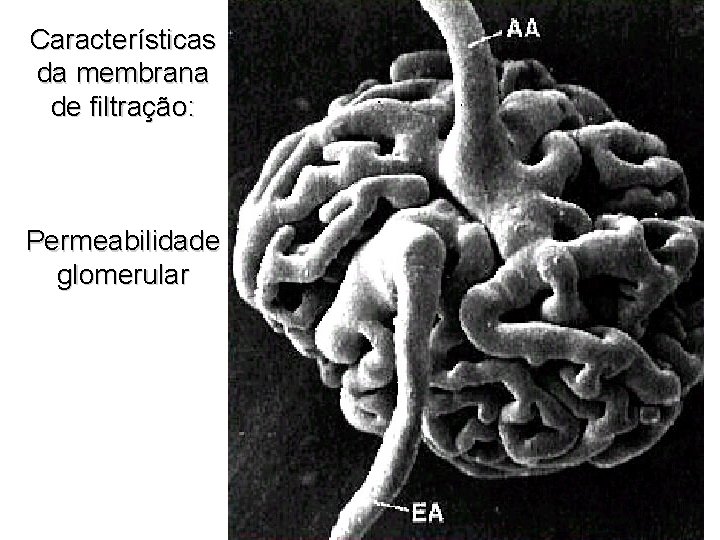 Características da membrana de filtração: Permeabilidade glomerular 
