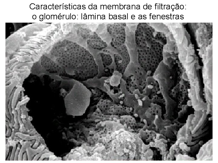 Características da membrana de filtração: o glomérulo: lâmina basal e as fenestras 