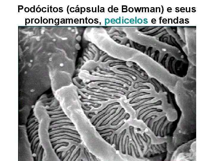 Podócitos (cápsula de Bowman) e seus prolongamentos, pedicelos e fendas 