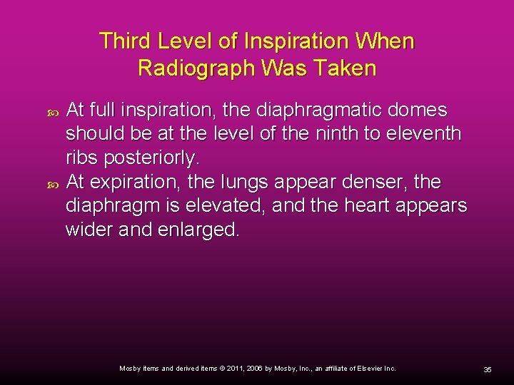 Third Level of Inspiration When Radiograph Was Taken At full inspiration, the diaphragmatic domes