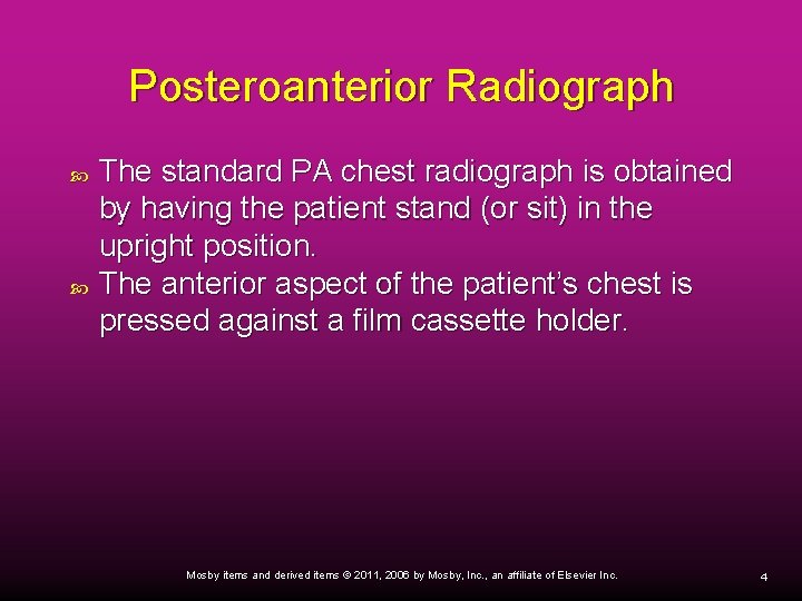 Posteroanterior Radiograph The standard PA chest radiograph is obtained by having the patient stand