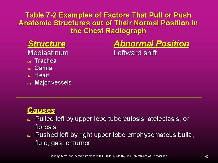 Table 7 -2 Examples of Factors That Pull or Push Anatomic Structures out of