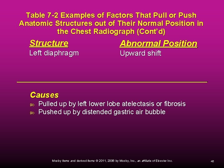 Table 7 -2 Examples of Factors That Pull or Push Anatomic Structures out of