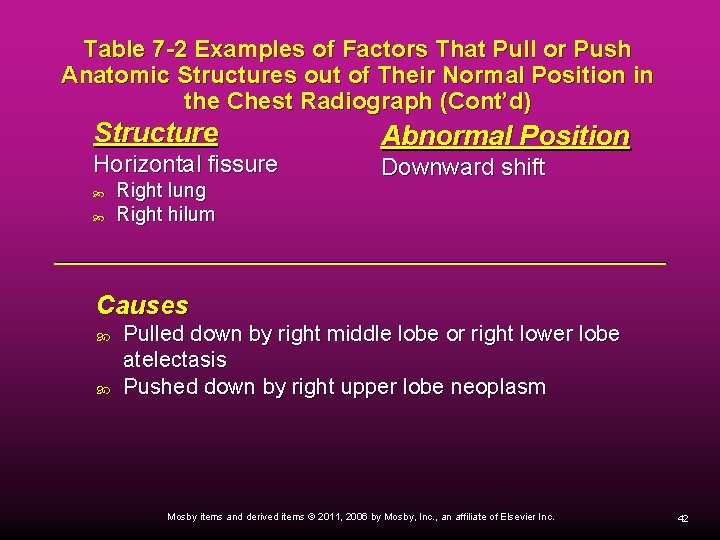 Table 7 -2 Examples of Factors That Pull or Push Anatomic Structures out of